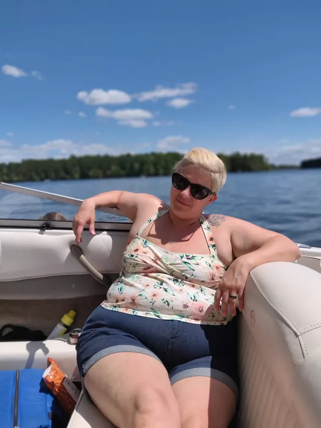 Then & Now. 4 years later with 850 ccs and fat lips bimbofied for your pleasure. 