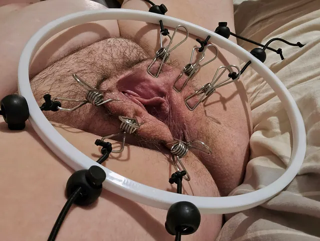 Homemade Labia Spreader 