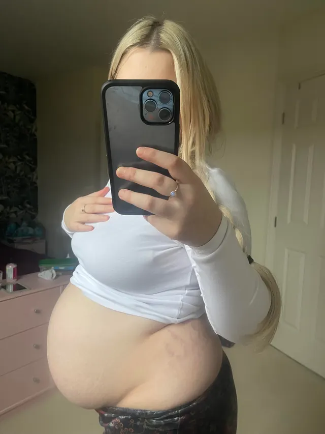 So many stretch marks ☺️