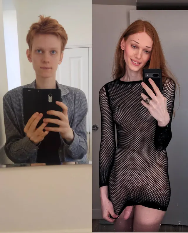 Before and after 2.5 year HRT. Did I do it right