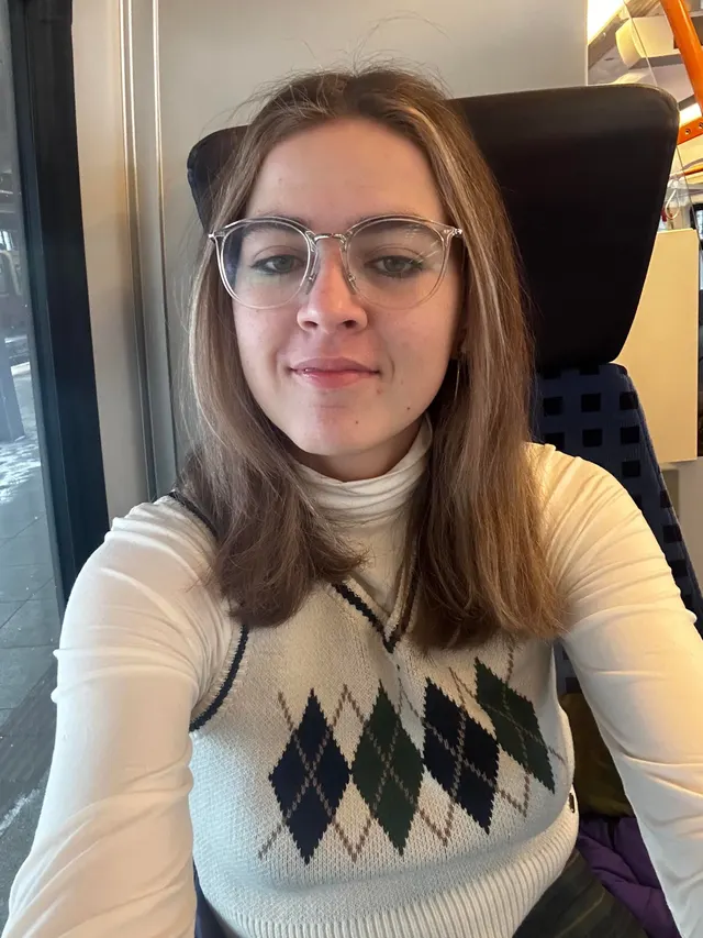 12ml fillers + Botox progress in one year