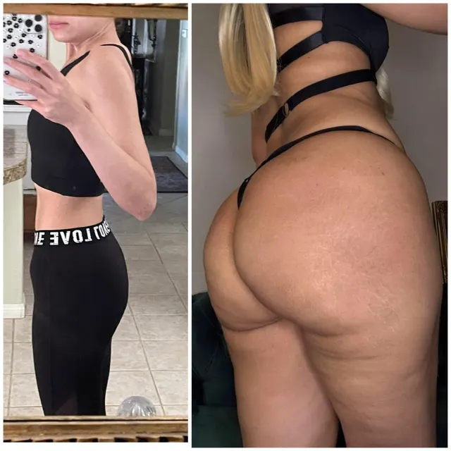 Beat anorexia and came out strong on the other side 🥵🐷🙈