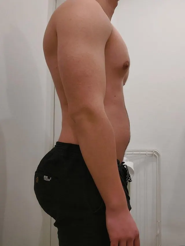 How to explain my parents that baseball had some unexpected consequences for my physique 🍑