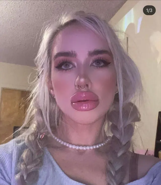 That vacant stare tho