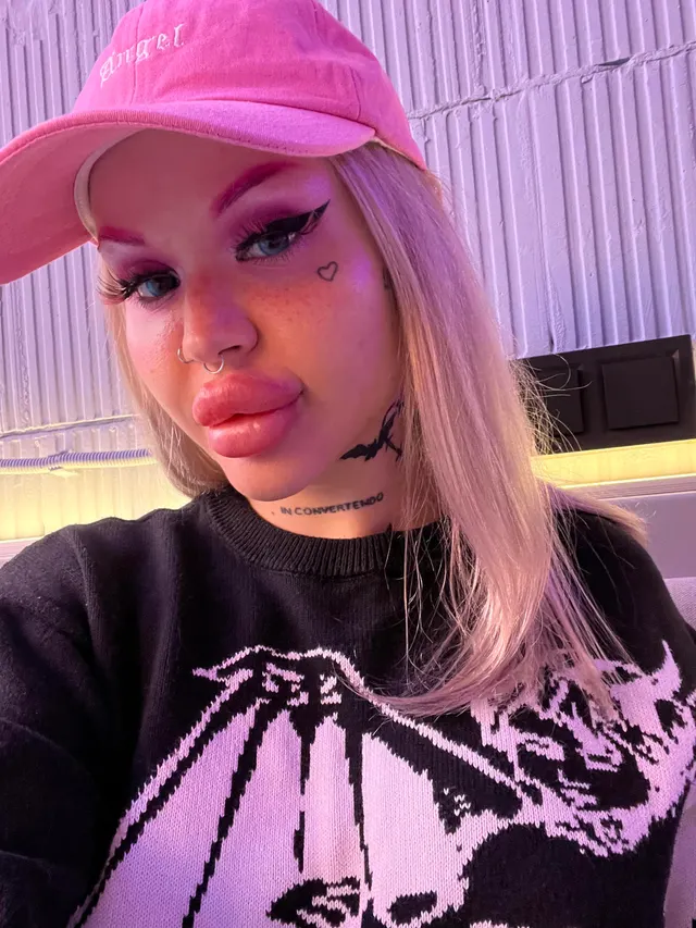 When im going to restaurant all people are staring on my lips