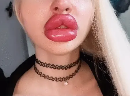 Lips so big they hide her piercing