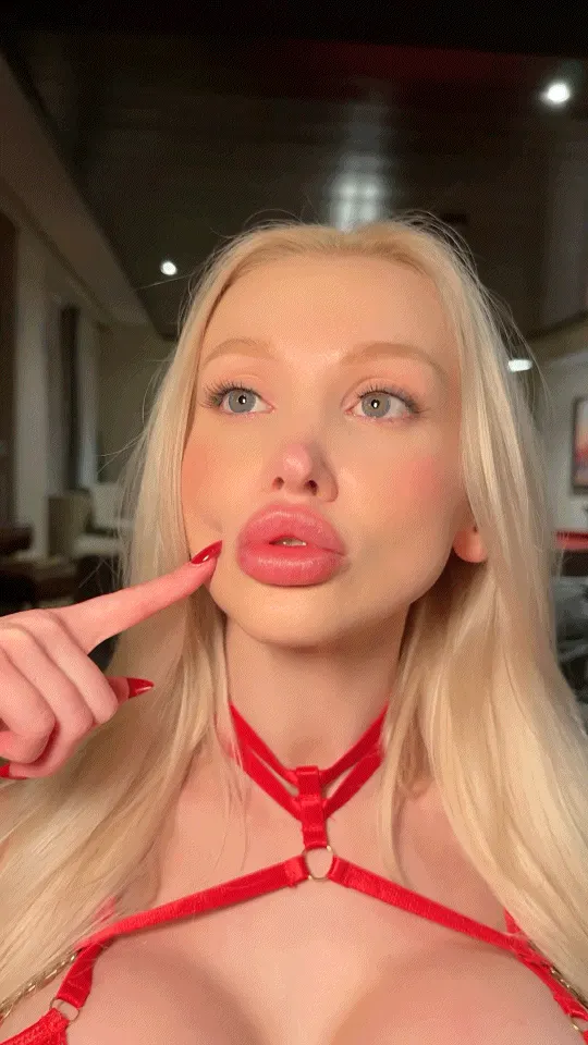 Showing off my overfilled pillow lips