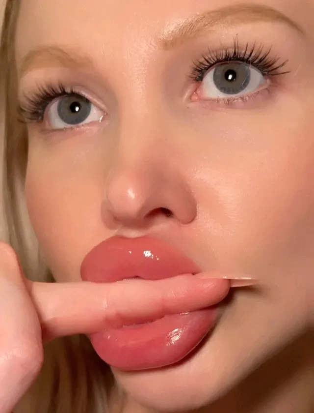 what do you prefer more bolted on lips or tits?