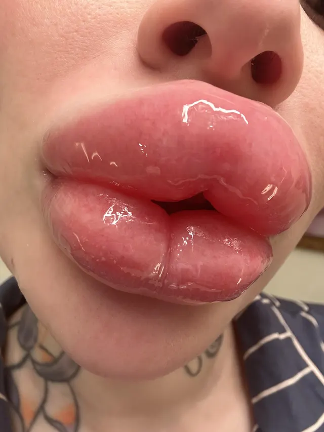 Biggest lips of Europe