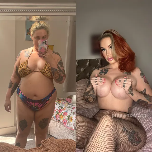 A progress update! 100lbs weight loss, boob job, lip filler & botox. Next up is my tummy tuck and lipo! 🩷💚🥰
