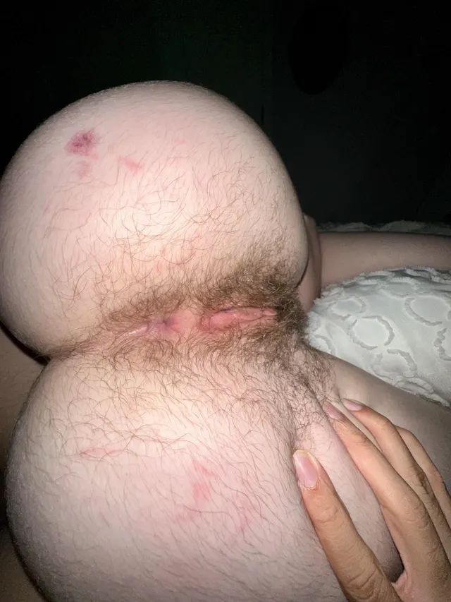 Do I look good like that or should o shaved 🪒??? [H]