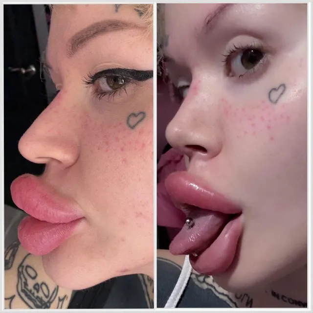 Got my face finally bimbofied😍