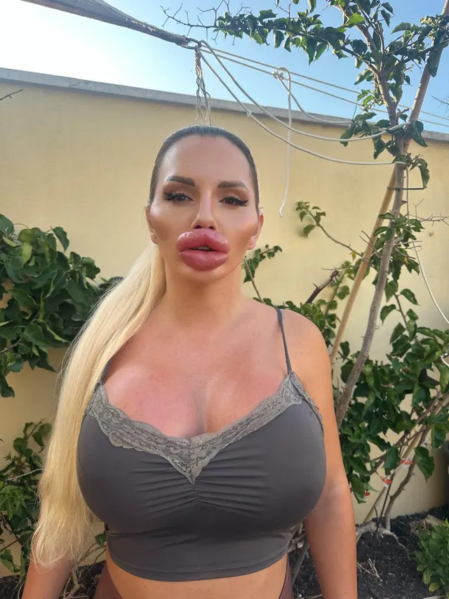 I don’t have a resting face, I have a resting pout