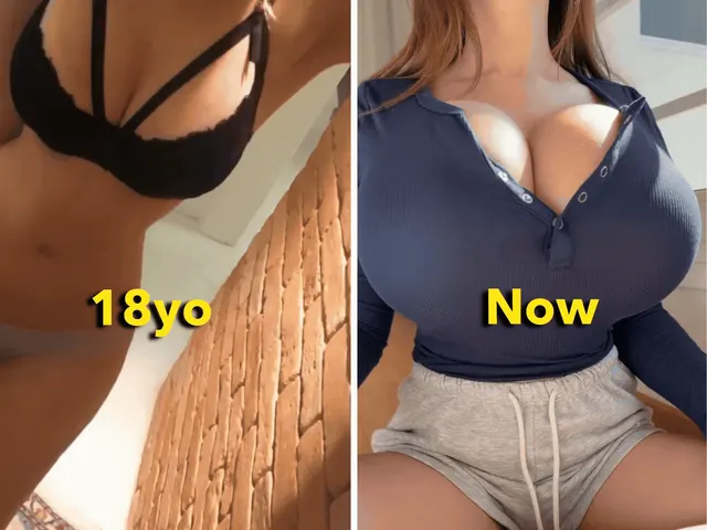 When ‘upgrade’ means +8 cup sizes