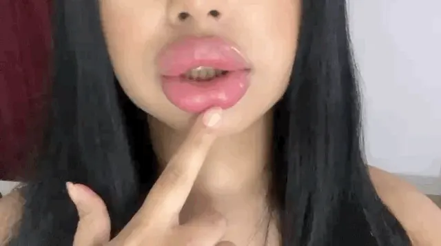 I urgently need fillers