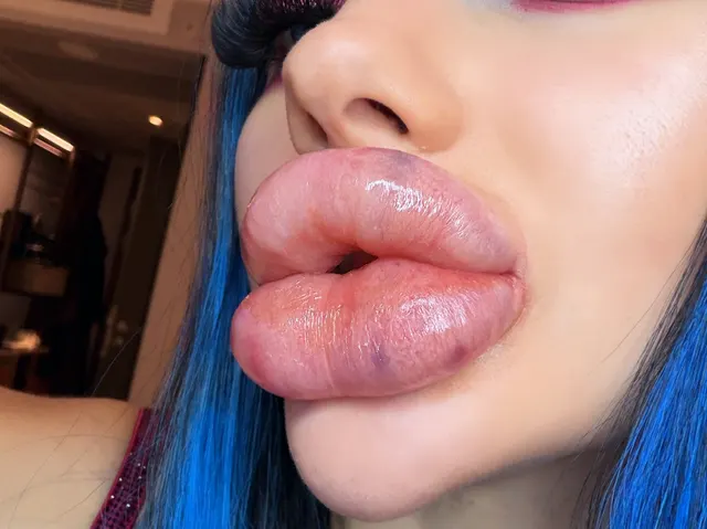 In love with my shiny fresh lips