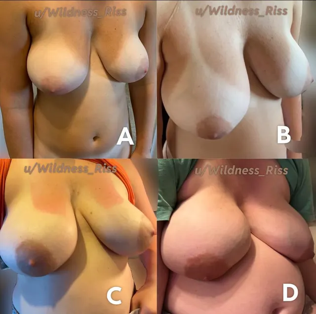 Transformation of my breasts the past 5 years. Which do you like?