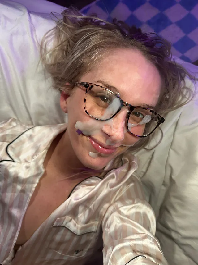 Rare achievement unlocked 🔓clear forehead for once! (perfect spot for yours)