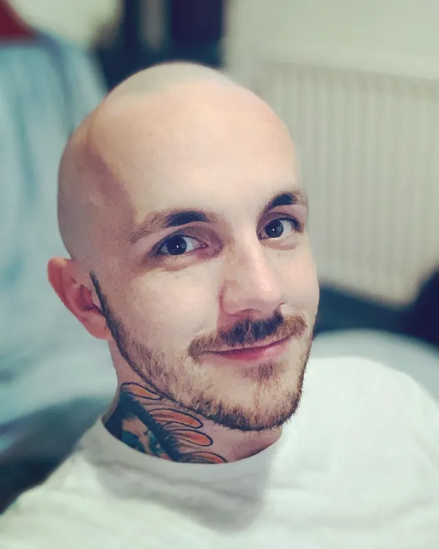 Bald spot, what bald spot? After years of insecurity over bald spots, I have finally taken the plunge.