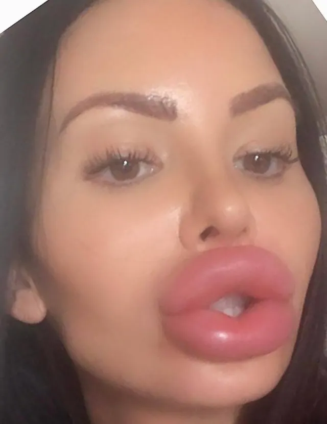 You don’t have to worry about being taken seriously when you can’t close your mouth