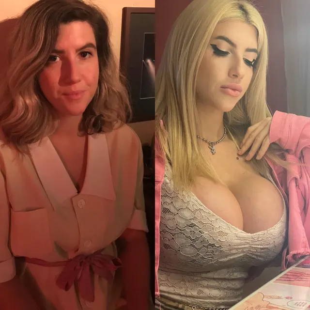 I used to have terrible acne and low self-esteem… I still have self-esteem issues but bimbofication has helped me so much. 🥰