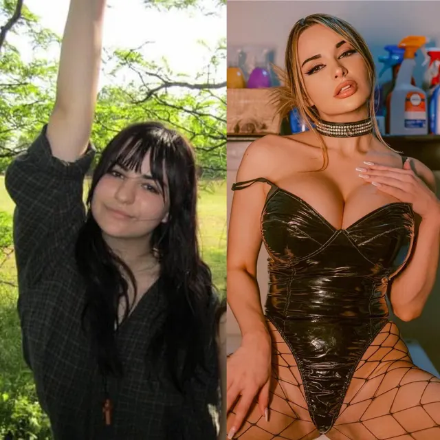 On my way to look like a blow up doll! I’m so proud of my journey so far though ☺️