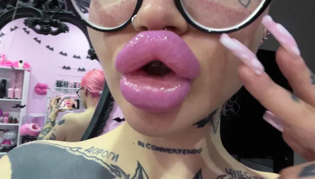 My freshly filled lips