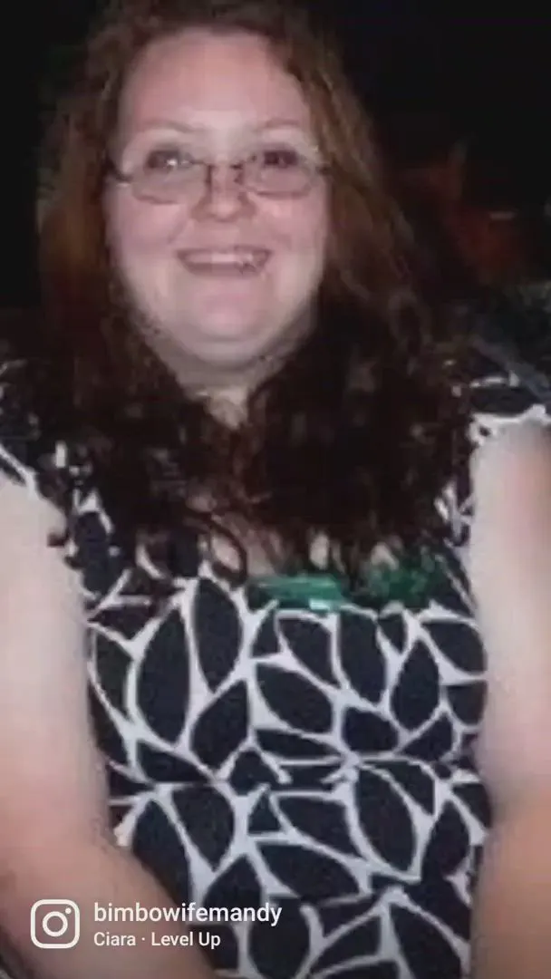 37F MILF Bimbo transformation video - 1650cc implants, weight loss, laser eye surgery, fillers, etc