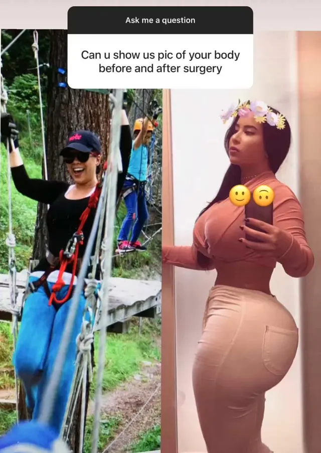 Amazing transformation